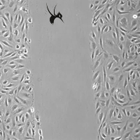 Image J/Fiji插件之划痕实验分析